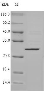 Greater than 90% as determined by SDS-PAGE.Recombinant Human Chymase (CMA1) Protein (His)