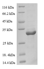 Greater than 90% as determined by SDS-PAGE.Recombinant Human Cellular Nucleic Acid-Binding Protein (CNBP) Protein (His-SUMO)