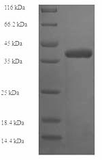 Greater than 90% as determined by SDS-PAGE.Recombinant Human Collagen alpha-1 (COL4A1) Protein (His-SUMO)