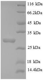 Greater than 90% as determined by SDS-PAGE.Recombinant Human Collagen alpha-3 (COL4A3) Protein (His)