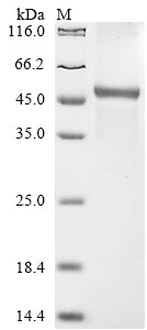 Greater than 85% as determined by SDS-PAGE.Recombinant Human Collagen alpha-2 (COL6A2) Protein (His-GST&Myc)
