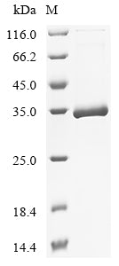 Greater than 90% as determined by SDS-PAGE.Recombinant Human Collagen alpha-1 (COL8A1) Protein (His-SUMO)