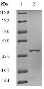 Greater than 90% as determined by SDS-PAGE.Recombinant Human Catechol O-Methyltransferase (COMT) Protein (His)