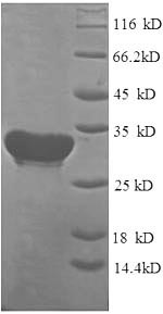 Greater than 90% as determined by SDS-PAGE.Recombinant Human Cytochrome C Oxidase Subunit 4 Isoform 1, Mitochondrial (COX4I1) Protein (His-SUMO)