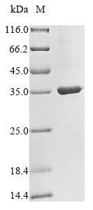 Greater than 85% as determined by SDS-PAGE.Recombinant Human Ceruloplasmin (CP) Protein (His&Myc)