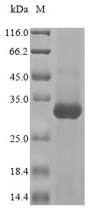 Greater than 85% as determined by SDS-PAGE.Recombinant Human Ceruloplasmin (CP) Protein (His)