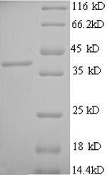 Greater than 90% as determined by SDS-PAGE.Recombinant Human Mast Cell Carboxypeptidase A (CPA3) Protein (His)