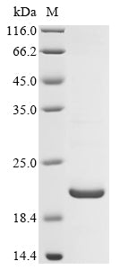 Greater than 90% as determined by SDS-PAGE.Recombinant Human Carbamoyl-Phosphate Synthase [Ammonia], Mitochondrial (CPS1) Protein (His)