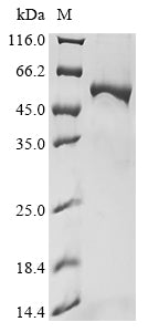 Greater than 90% as determined by SDS-PAGE.Recombinant Human Carnitine O-Palmitoyltransferase 2, Mitochondrial (CPT2) Protein (His&Myc)
