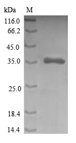 Greater than 90% as determined by SDS-PAGE.