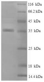 Greater than 90% as determined by SDS-PAGE.Recombinant Human Alpha-Crystallin B Chain (CRYAB) Protein (His-SUMO)