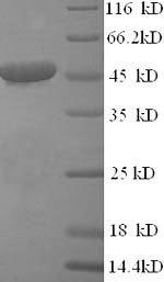 Greater than 90% as determined by SDS-PAGE.Recombinant Human Citrate Synthase, Mitochondrial (CS) Protein (His)