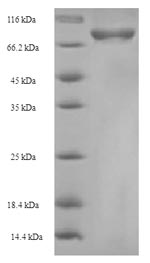 Greater than 90% as determined by SDS-PAGE.Recombinant Mouse Cysteine Sulfinic Acid Decarboxylase (CSAD) Protein (His-SUMO)
