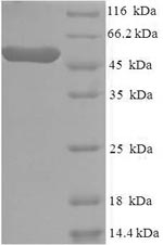 Greater than 90% as determined by SDS-PAGE.Recombinant Human Casein Kinase I Isoform Epsilon (CSNK1E) Protein (His)