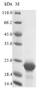 Greater than 85% as determined by SDS-PAGE.Recombinant Mouse Cystatin-C (CST3) Protein (His&Myc)