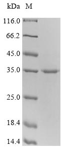 Greater than 90% as determined by SDS-PAGE.Recombinant Mouse Cytotoxic T-Lymphocyte Protein 4 (CTLA4) Protein (His-SUMO&Myc)