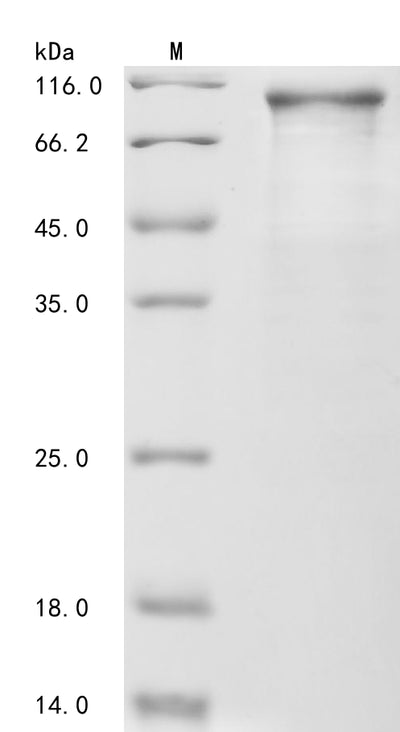 Greater than 85% as determined by SDS-PAGE.Recombinant Human Catenin Beta-1 (CTNNB1) Protein (His)