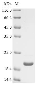 Greater than 85% as determined by SDS-PAGE.Recombinant Mouse Dipeptidyl Peptidase 1 (CTSC) Protein (His&Myc)