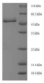Greater than 90% as determined by SDS-PAGE.Recombinant Chinese Hamster Cathepsin D (CTSD) Protein (His-SUMO)