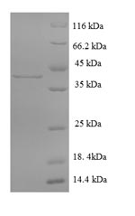Greater than 90% as determined by SDS-PAGE.