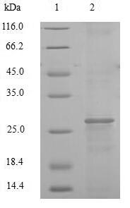 Greater than 90% as determined by SDS-PAGE.Recombinant Human Cathepsin K (CTSK) Protein (His)