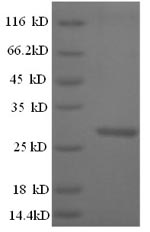 Greater than 90% as determined by SDS-PAGE.Recombinant Mouse Cathepsin K (CTSK) Protein (His)