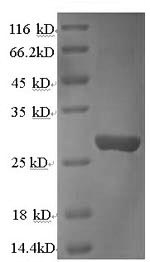 Greater than 90% as determined by SDS-PAGE.Recombinant Rat Cathepsin K (CTSK) Protein (His)