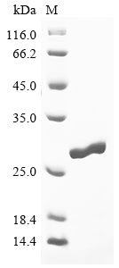 Greater than 90% as determined by SDS-PAGE.Recombinant Fasciola Hepatica Cathepsin L2 Protein (GST)