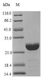 Greater than 90% as determined by SDS-PAGE.Recombinant Human Cathepsin S (CTSS) Protein (His)