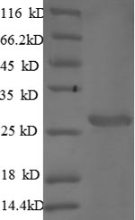 Greater than 90% as determined by SDS-PAGE.Recombinant Mouse Cathepsin S (CTSS) Protein (His)