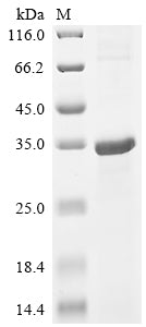Greater than 85% as determined by SDS-PAGE.