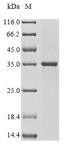 Greater than 85% as determined by SDS-PAGE.Recombinant Mouse Cathepsin W (CTSW) Protein (His&Myc)