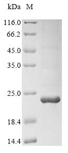 Greater than 85% as determined by SDS-PAGE.Recombinant Mouse C-X-C Chemokine Receptor Type 3 (CXCR3) Protein (His-KSI)