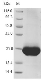 Greater than 90% as determined by SDS-PAGE.Recombinant Human C-X-C Chemokine Receptor Type 4 (CXCR4) Protein (His-SUMO&Myc)