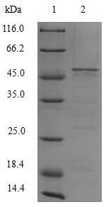 Greater than 90% as determined by SDS-PAGE.Recombinant Human Cytochrome B-245 Heavy Chain (CYBB) Protein (His-SUMO)