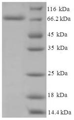 Greater than 90% as determined by SDS-PAGE.Recombinant Human Cholesterol Side-Chain Cleavage Enzyme, Mitochondrial (CYP11A1) Protein (His-SUMO)