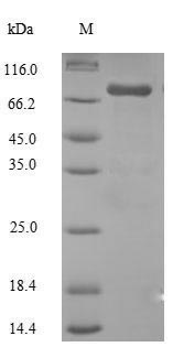 Greater than 90% as determined by SDS-PAGE.Recombinant Human Steroid 17-Alpha-Hydroxylase/17,20 Lyase (CYP17A1) Protein (GST)