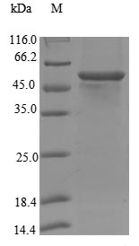 Greater than 90% as determined by SDS-PAGE.Recombinant Human Steroid 17-Alpha-Hydroxylase/17,20 Lyase (CYP17A1) Protein (His)