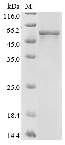 Greater than 85% as determined by SDS-PAGE.Recombinant Human Aromatase (CYP19A1) Protein (His)