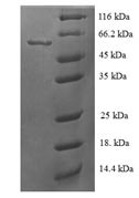 Greater than 90% as determined by SDS-PAGE.Recombinant Human Steroid 21-Hydroxylase (CYP21A2) Protein (His)