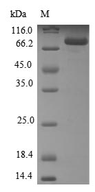 Greater than 85% as determined by SDS-PAGE.Recombinant Human Steroid 21-Hydroxylase (CYP21A2) Protein (GST)