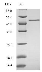 Greater than 90% as determined by SDS-PAGE.Recombinant Human Ccn Family Member 1 (CYR61) Protein (His-SUMO)