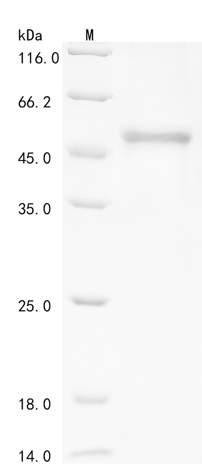 Greater than 85% as determined by SDS-PAGE.Recombinant Human Deleted In Azoospermia-Like (DAZL) Protein (His-GST&V5-Myc)