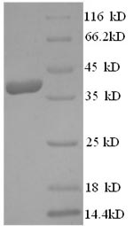 Greater than 90% as determined by SDS-PAGE.Recombinant Human Dermcidin (DCD) Protein (GST)