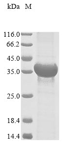 Greater than 85% as determined by SDS-PAGE.