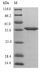 Greater than 85% as determined by SDS-PAGE.Recombinant Mouse Decorin (DCN) Protein (His)