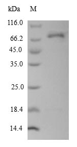 Greater than 90% as determined by SDS-PAGE.Recombinant Human L-Dopachrome Tautomerase (DCT) Protein (His-SUMO&Myc)