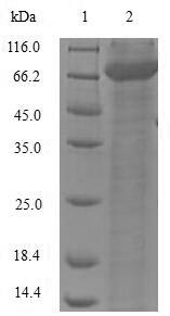 Greater than 90% as determined by SDS-PAGE.Recombinant Mouse L-Dopachrome Tautomerase (DCT) Protein (His-SUMO&Myc)