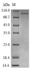 Greater than 90% as determined by SDS-PAGE.Recombinant Human Atp-Dependent Rna Helicase Ddx3X (DDX3X) Protein (His-B2M)