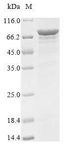 Greater than 85% as determined by SDS-PAGE.Recombinant Human Probable Atp-Dependent Rna Helicase Ddx5 (DDX5) Protein (His&Myc)